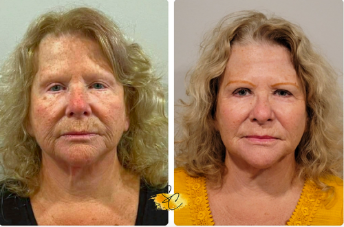 Jetta-High-and-low-energy-30-days-after