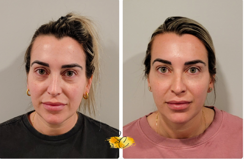 Kelly-Low-energy-60-days-after