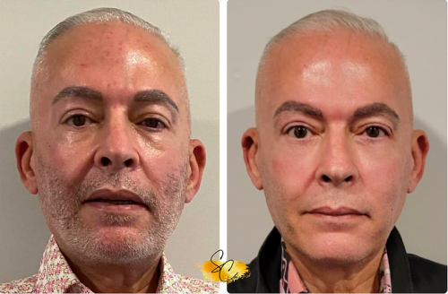 Low-high-energy-60-days-after male 60s