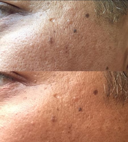 pore size b and a _20220913_201901